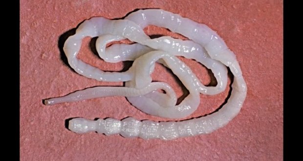 Какие существуют лекарства от глистов: ленточных, круглых червей, сосальщиков