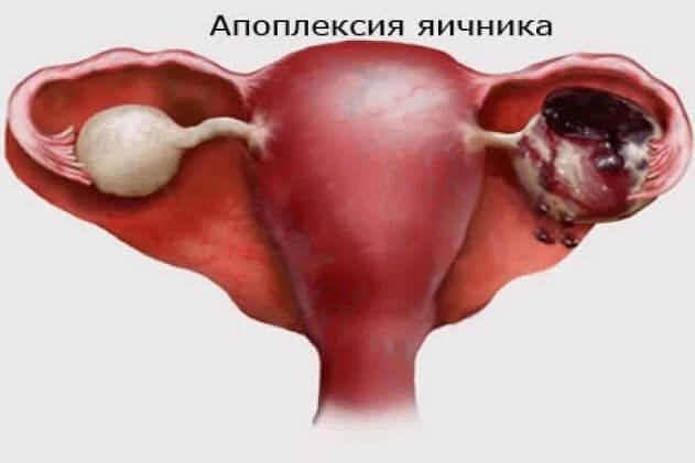 Колет в правом боку внизу живота у женщины, у мужчины: причины недуга, характеристика заболеваний, неотложная помощь