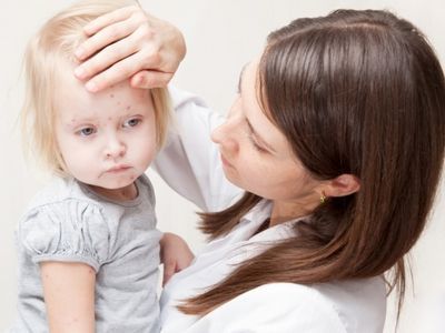 Контагиозный моллюск у ребенка: особенности и симптомы патологии, эффективные методы лечения