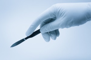 Короткая уздечка крайней плоти: операция, пластика короткой уздечки полового члена