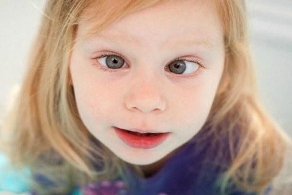 Косоглазие у детей: причины, симптомы, диагностика, лечение расходящегося и сходящегося косоглазия