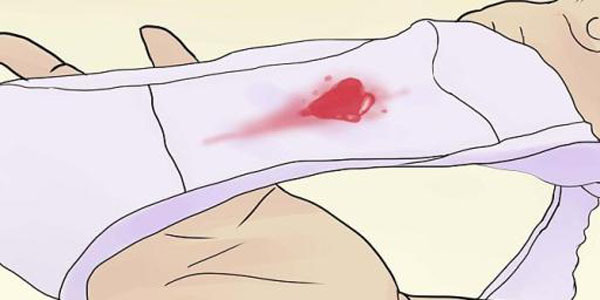 Кровотечение на раннем сроке беременности — что делать: первая помощь и лечение кровотечений в первой половине беременности. 