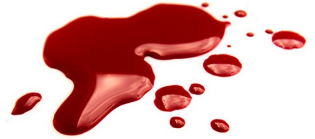 Кровотечение при климаксе: провоцирующие факторы, классификация выделений, методы обследования и лечения
