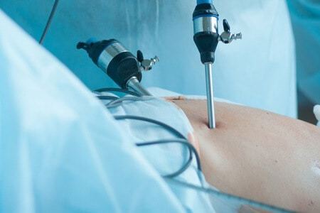 Лапароскопия в гинекологии: показания и противопоказания, правила подготовки, проведение процедуры и восстановление