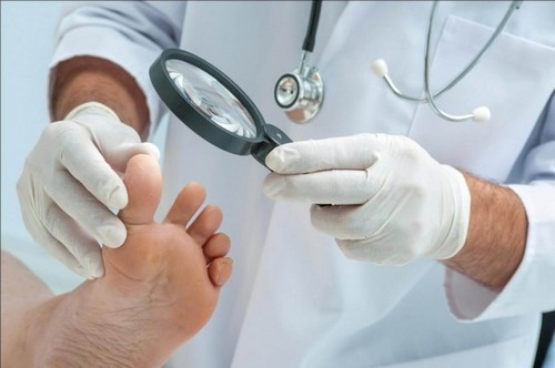 Лечение запущенного грибка ногтей: эффективные средства для лечения