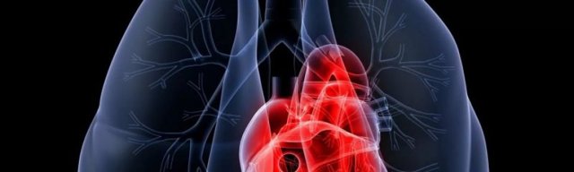 Легочное сердце: этиология развития, клинические проявления, диагностика и тактика лечения