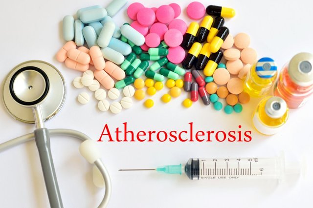Лекарственные препараты для лечения атеросклероза: самые эффективные медикаментозные и растительные средства