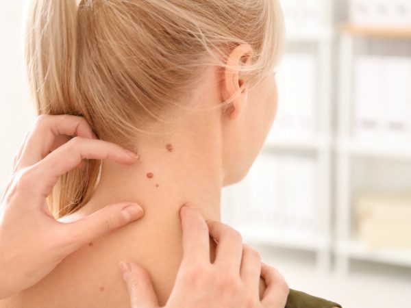 Лейомиосаркома кожи: причины возникновения, типичные признаки, принципы лечения и прогноз