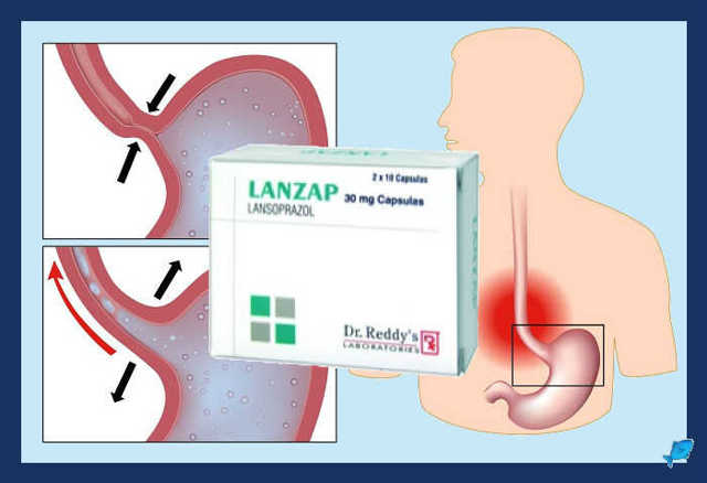 Лоэнзар-Сановель 30 мг: от чего помогает, инструкция по применению, аналоги