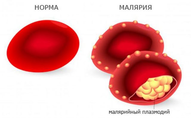 Малярия: виды возбудителя и жизненный цикл плазмодия, диагностические критерии и лечение