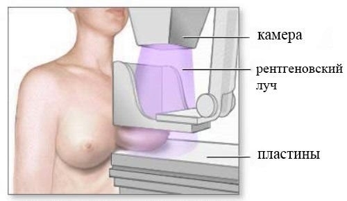Маммография молочных желез: на какой день цикла делать, что показывает, когда проходить