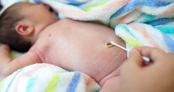 Мокнущий пупок у новорожденных: симптомы и лечение омфалита у младенцев