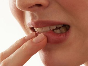 Молочница во рту: причины возникновения, симптомы и методы лечения орального кандидоза с подробными фото