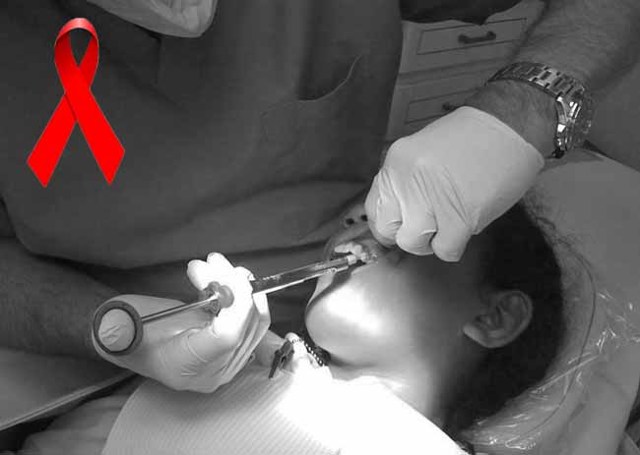 Можно ли заразиться ВИЧ в стоматологии: условия инфицирования, меры предостережения, стерилизация в клинике