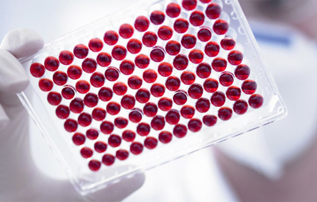 На что указывает сильное повышение антител при анализе крови ифа?