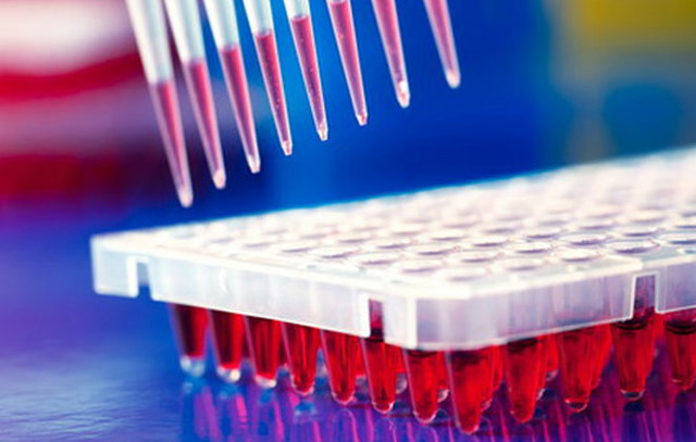 На что указывает сильное повышение антител при анализе крови ифа?