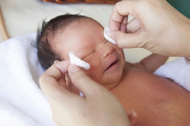 Непроходимость слезного канала у новорожденных: симптомы и лечение дакриоцистита