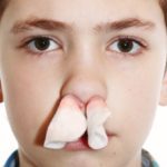 Носовое кровотечение у детей и взрослых: причины частых носовых кровотечений, первая помощь при носовом кровотечении и методы остановки кровотечения из носа