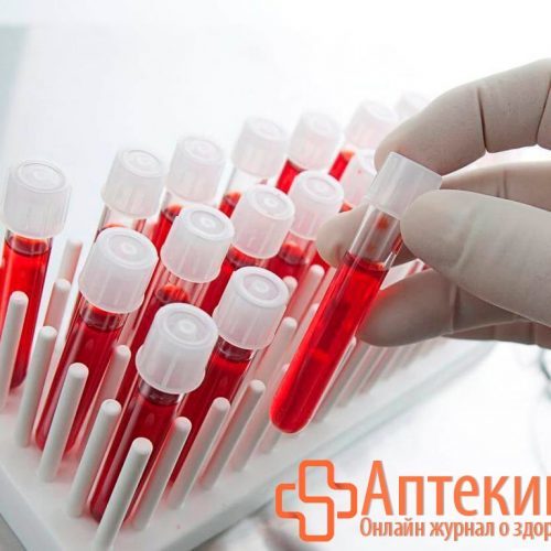 О чем говорит повышение асл-о (антистрептолизина-о) в анализе крови?