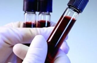Общий анализ крови: нормы, расшифровка анализа крови, подготовка к анализу крови