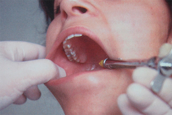 Опухла щека, но зуб не болит: причины воспаления, как снять опухоль, что делать с отеком внутри полости рта
