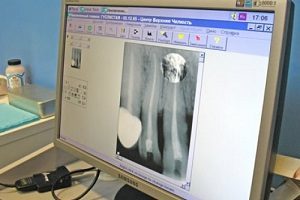 Ортопантомограмма зубов: значение сканирования, показания и противопоказания к проведению, стоимость диагностики