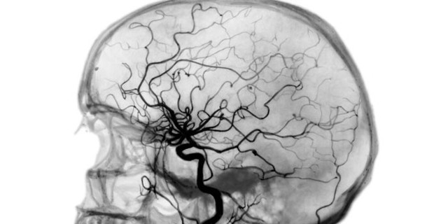 Особенности проведения УЗИ сосудов головного мозга и шеи: суть ультразвукового исследования