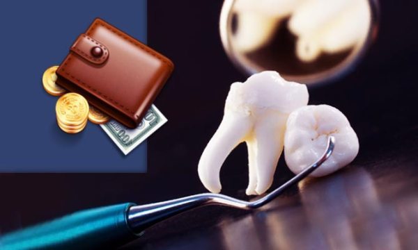 Патологическая подвижность зубов у взрослых – что делать?