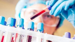 Пайпель-биопсия эндометрия с гистологическим исследованием: показания и ограничения, подготовка к процедуре, порядок проведения