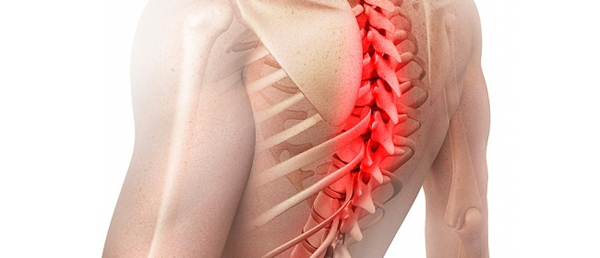 Перелом грудного отдела позвоночника: причины травмы, клинические признаки, лечебные мероприятия, возможные последствия
