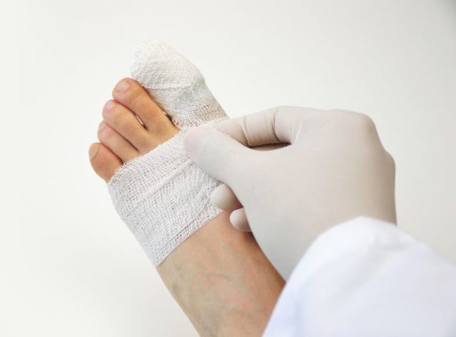 Перелом пальца на ноге: провоцирующие факторы, характерные признаки, первая помощь и тактика лечение