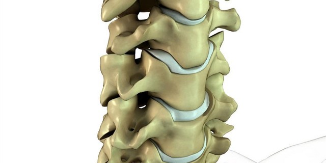Перелом шейного отдела позвоночника: характерные признаки, неотложная помощь при повреждении спинного мозга, методы лечения
