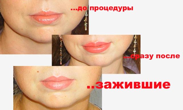 Перманентный макияж губ, бровей, глаз: фото до и после, преимущества и недостатки татуажа