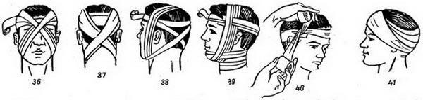 Первая помощь при ранении головы: повязка, обработка раны при ранении волосистой части головы