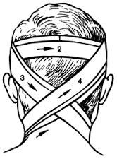 Первая помощь при ранении головы: повязка, обработка раны при ранении волосистой части головы
