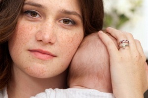 Пигментные пятна при беременности на лице: как избавиться от них в домашних условиях