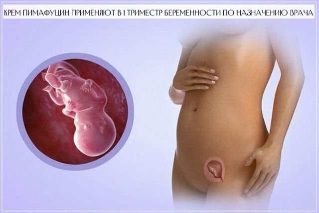 Пимафуцин свечи: инструкция по применению, аналоги, можно ли при беременности