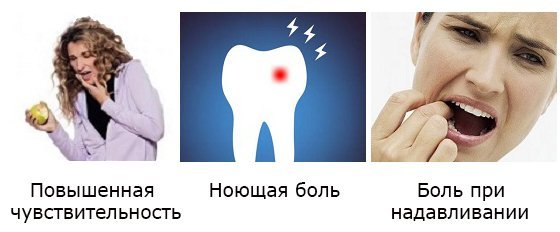 Пломбирование зубных каналов: особенности процедуры, возможные осложнения, методы снятия боли