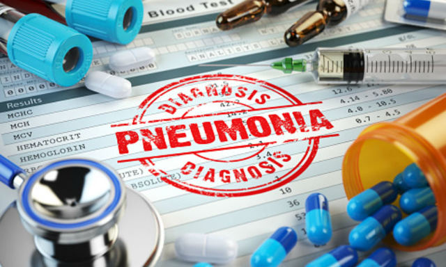 Пневмония: причины и признаки воспаления легких у взрослых, современные методы лечения