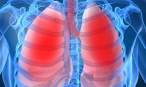 Пневмония: причины и признаки воспаления легких у взрослых, современные методы лечения