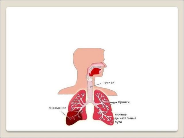 Пневмония у детей: особенности течения, характерные симптомы и лечение воспаления легких в домашних условиях