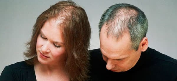 Почему выпадают волосы у женщины в молодом возрасте: главные причины и методы устранения проблемы