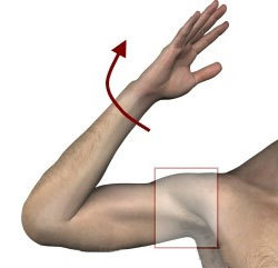 Подвывих плечевого сустава: причины и классификация повреждения, характерные симптомы, тактика лечения