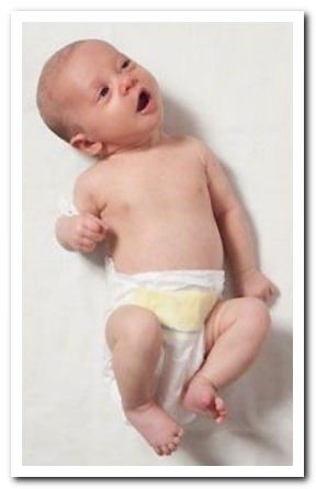 Подвывих шейного позвонка при родах у ребенка, у взрослого: лечение и последствия