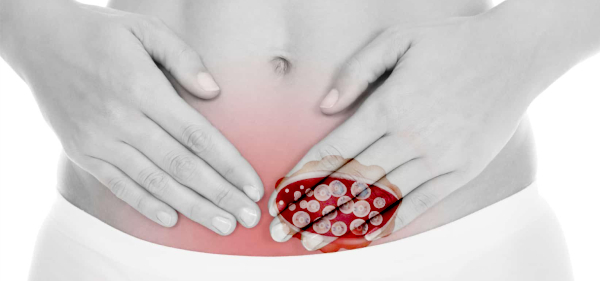 Поликистоз яичников: причины и лечение, прогноз беременности