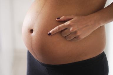 Полоска на животе у беременных: причины появления, когда исчезает, как это влияет на пол ребенка