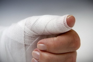 Помощь при травматической ампутации конечности: пальца, кисти, руки, стопы
