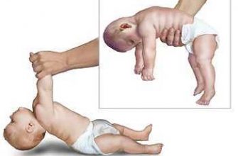 Пониженный тонус мышц у ребенка: физиологическое состояние с момента рождения и возрастные нормы, диагностика и характер нарушений, возможные причины и способы лечения