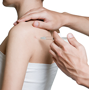 Посттравматический артроз плечевого сустава: степени патологии, характерные симптомы, способы лечения и упражнения для восстановления