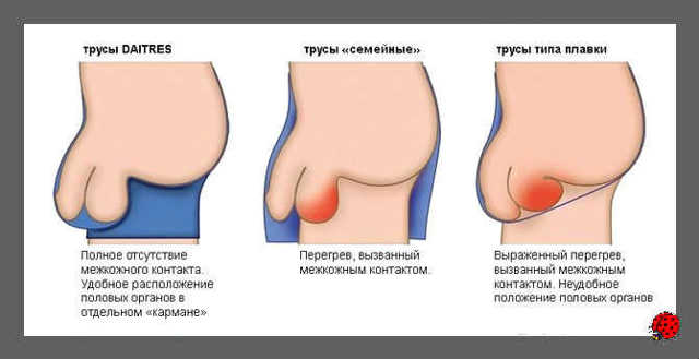 Прыщи на мошонке: причины появления и методы лечения сыпи на интимном органе